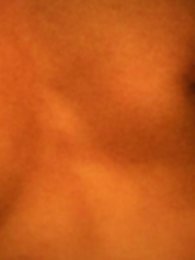 Blue toenails under sun ray